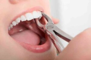 tooth extraction and dentures the same day