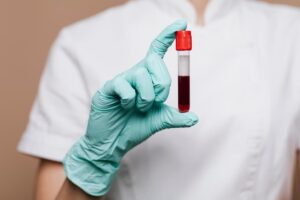 Where To Get Blood Work Done For Free