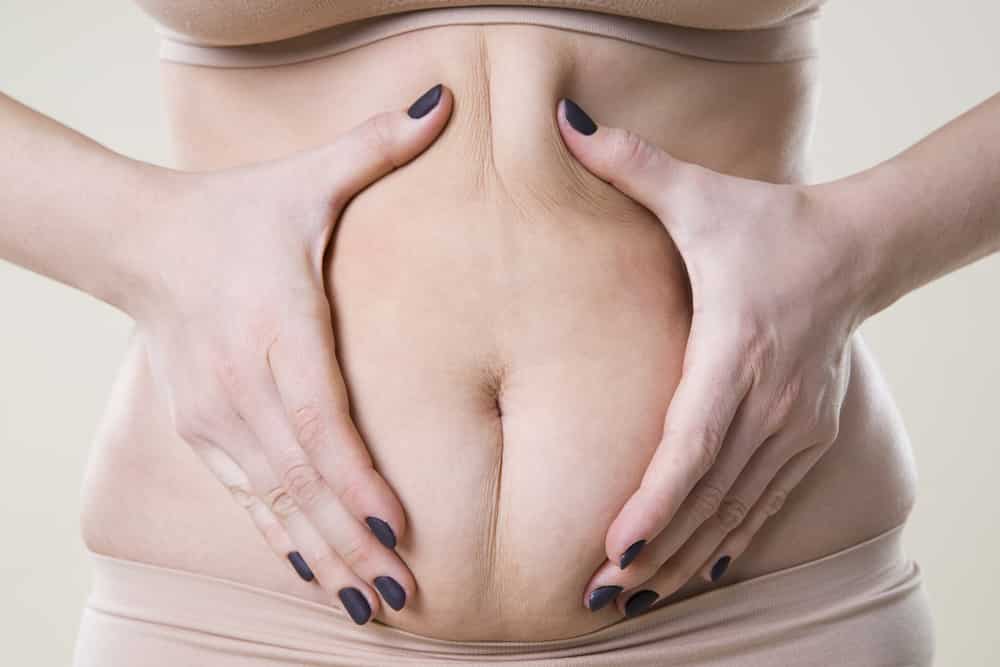Facts about tummy tucks