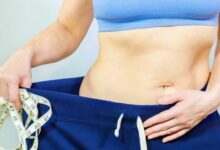 Lifestyle Changes and Exercise After Tummy Tuck Maintaining Results